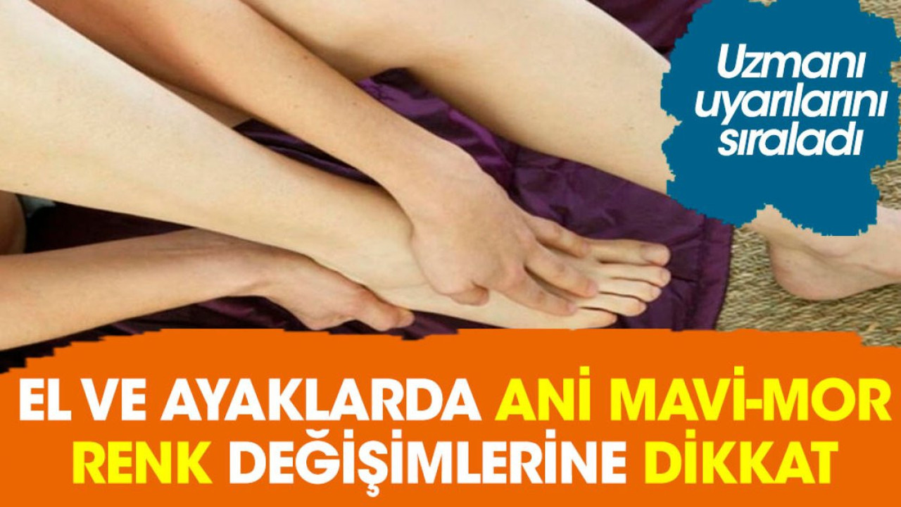El ve ayaklarda ani mavi-mor renk değişimlerine dikkat. Uzmanı uyarılarını sıraladı