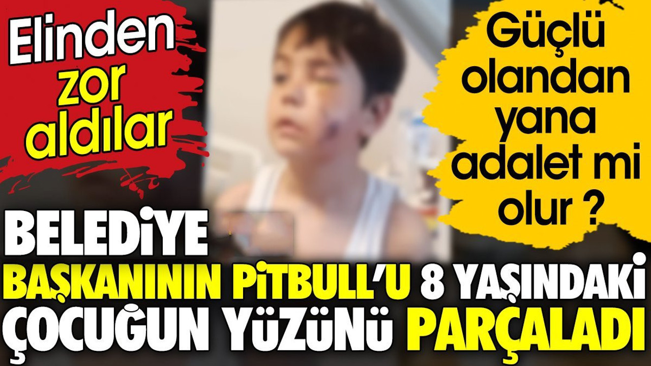Belediye Başkanının Pitbull'u 8 yaşındaki çocuğun yüzünü parçaladı