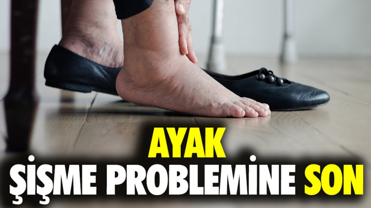 Ayak şişme problemine son