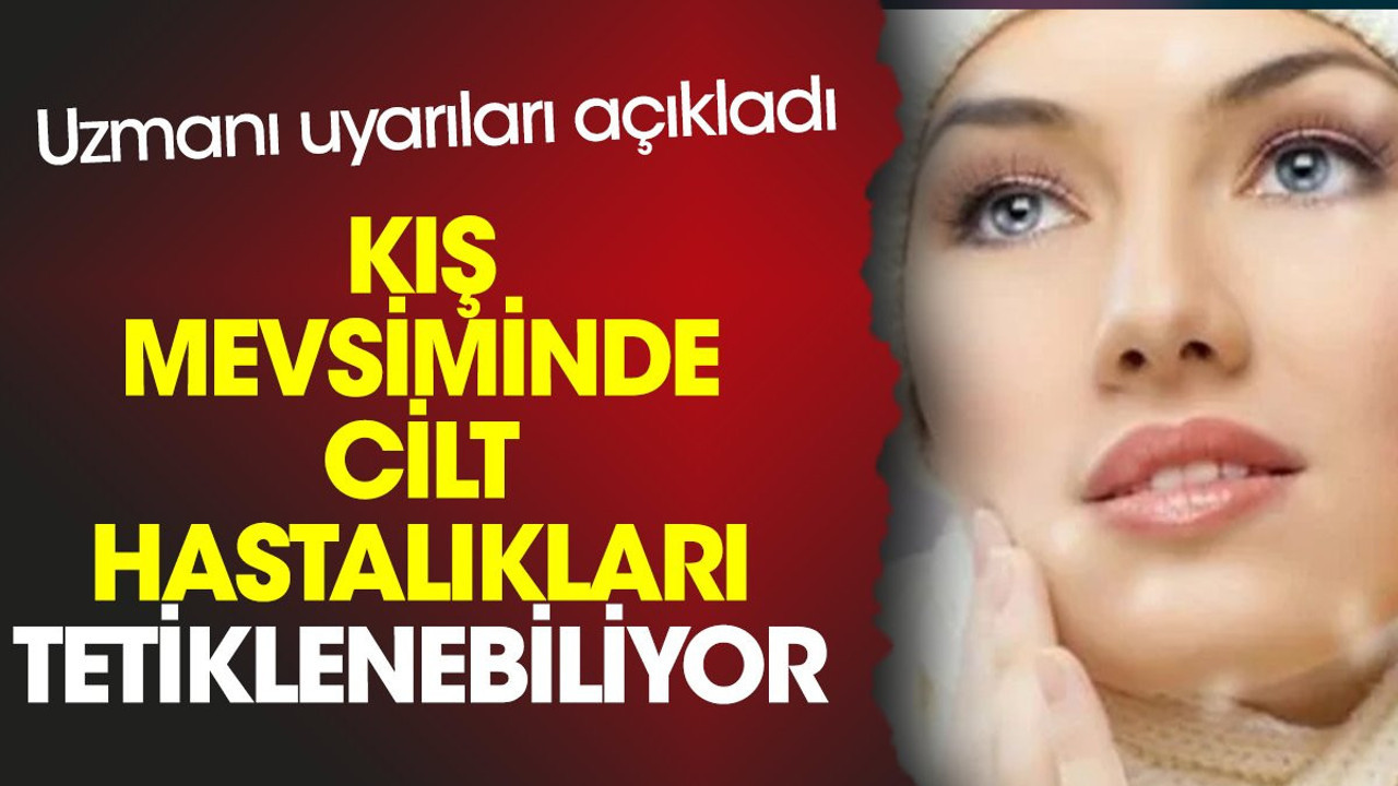 Kış mevsiminde cilt hastalıkları tetiklenebiliyor. Uzmanı uyarıları açıkladı