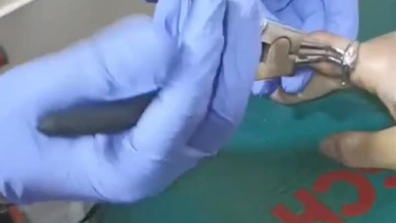 Parmakta sıkışan yüzüğü itfaiye çıkardı