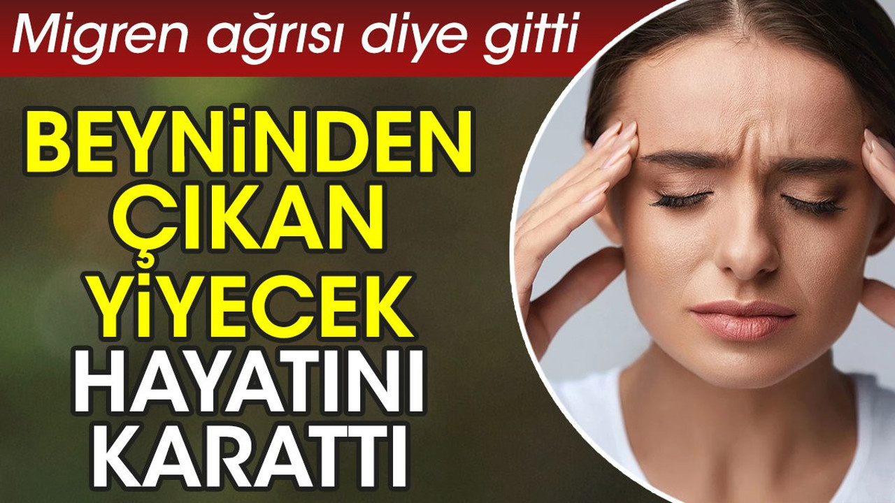 Migren ağrısı diye gitti beyninden çıkan yiyecek hayatını karattı