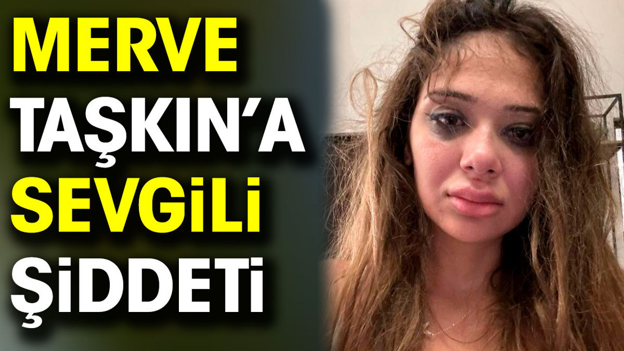 Sosyal medya fenomeni Merve Taşkın sevgilisinden gördüğü şiddeti paylaştı