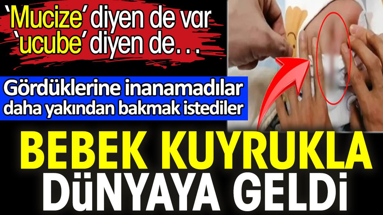 Bebek kuyrukla dünyaya geldi. ‘Mucize’ diyen de var ‘ucube’ diyen de…