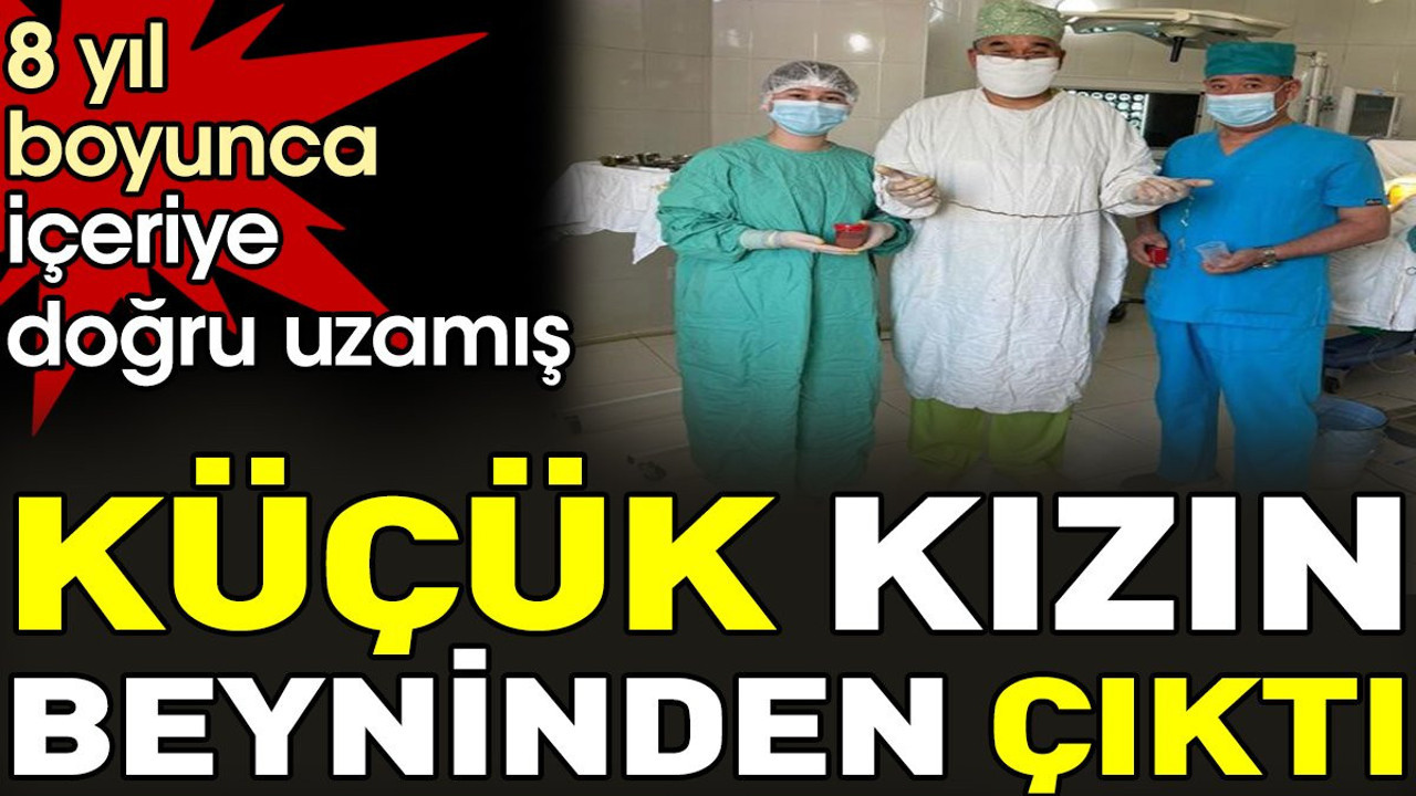 Küçük kızın beyninden çıktı. 8 yıl boyunca içeriye doğru uzamış