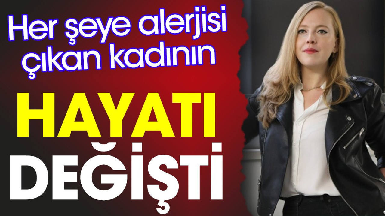Her şeye alerjisi çıkan kadının hayatı değişti