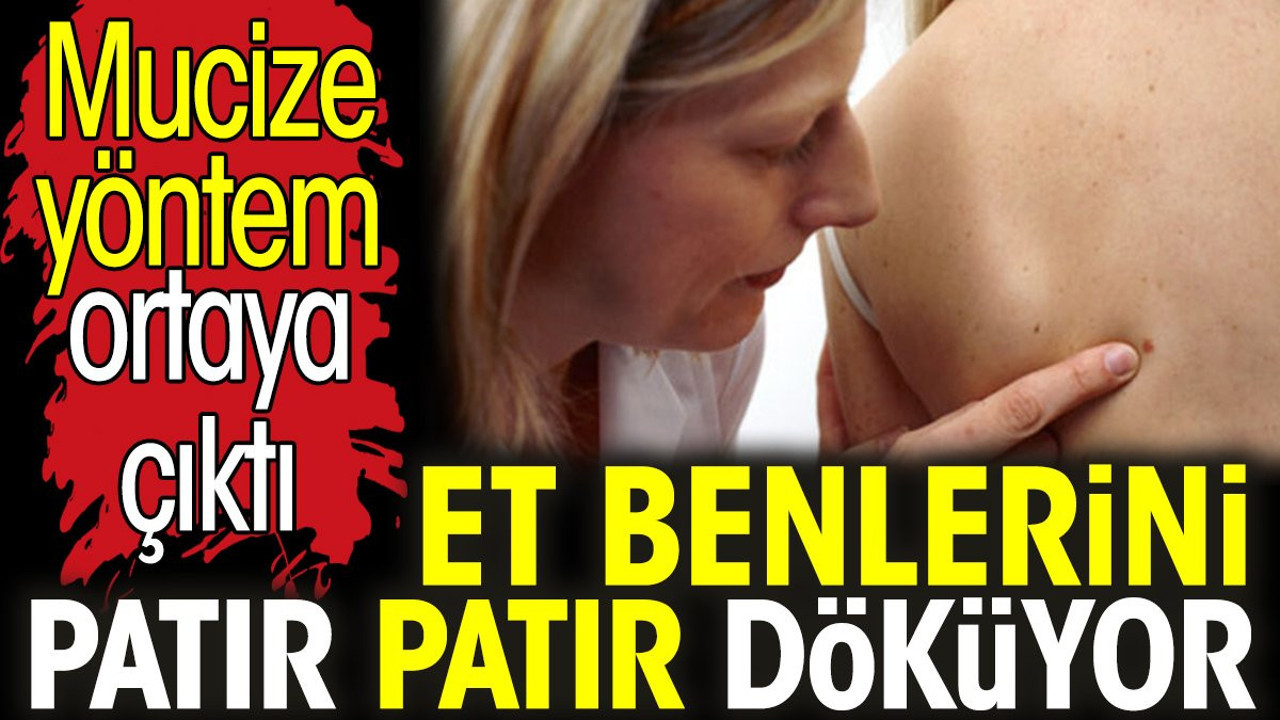 Et benlerini patır patır döküyor. Mucize yöntem ortaya çıktı