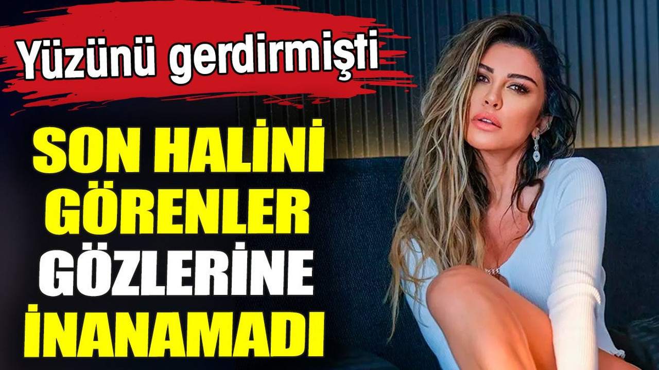 Yüzünü gerdirmişti. Son halini görenler gözlerine inanamadı