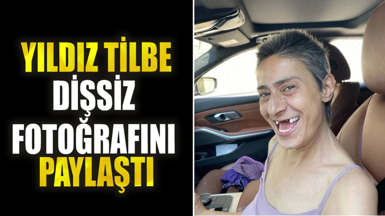 Yıldız Tilbe dişsiz fotoğrafını paylaştı