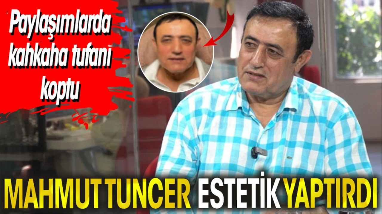Mahmut Tuncer estetik yaptırdı. Paylaşımlarda kahkaha tufanı koptu