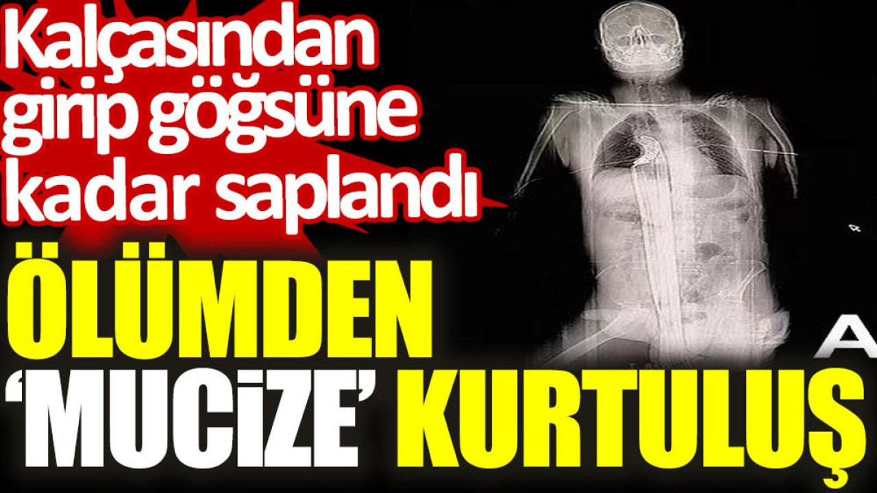 Ölümden ‘mucize’ kurtuluş: Kalçasından girip göğsüne kadar saplandı