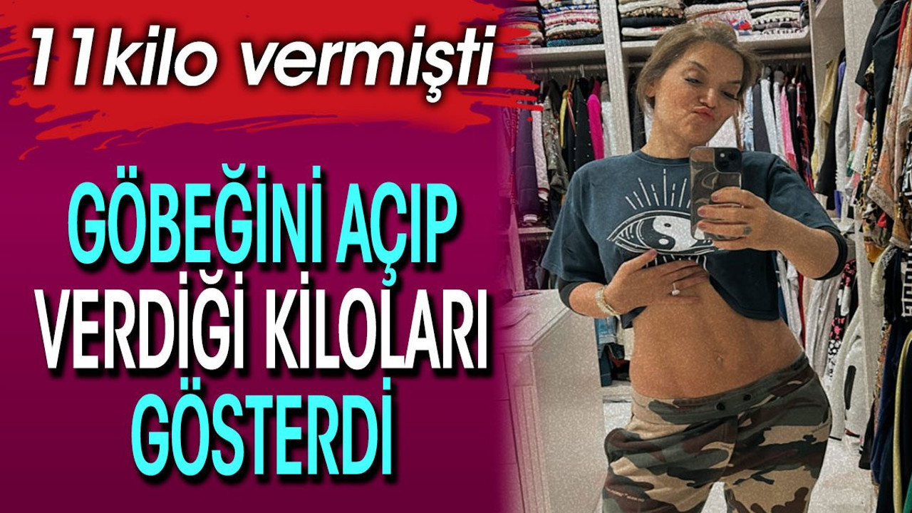 11 kilo veren Demet Akalın göbeğini açıp verdiği kiloları gösterdi