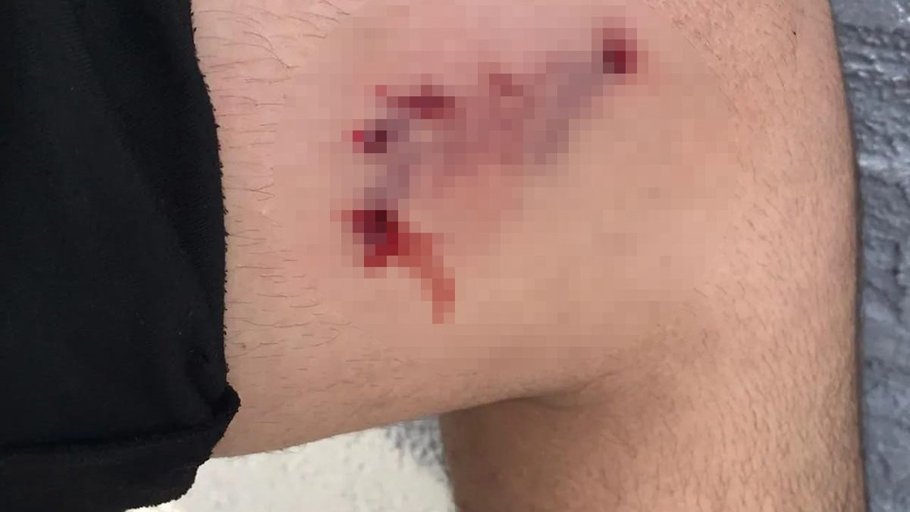 Evine giderken sokak köpeklerinin saldırısına uğradı