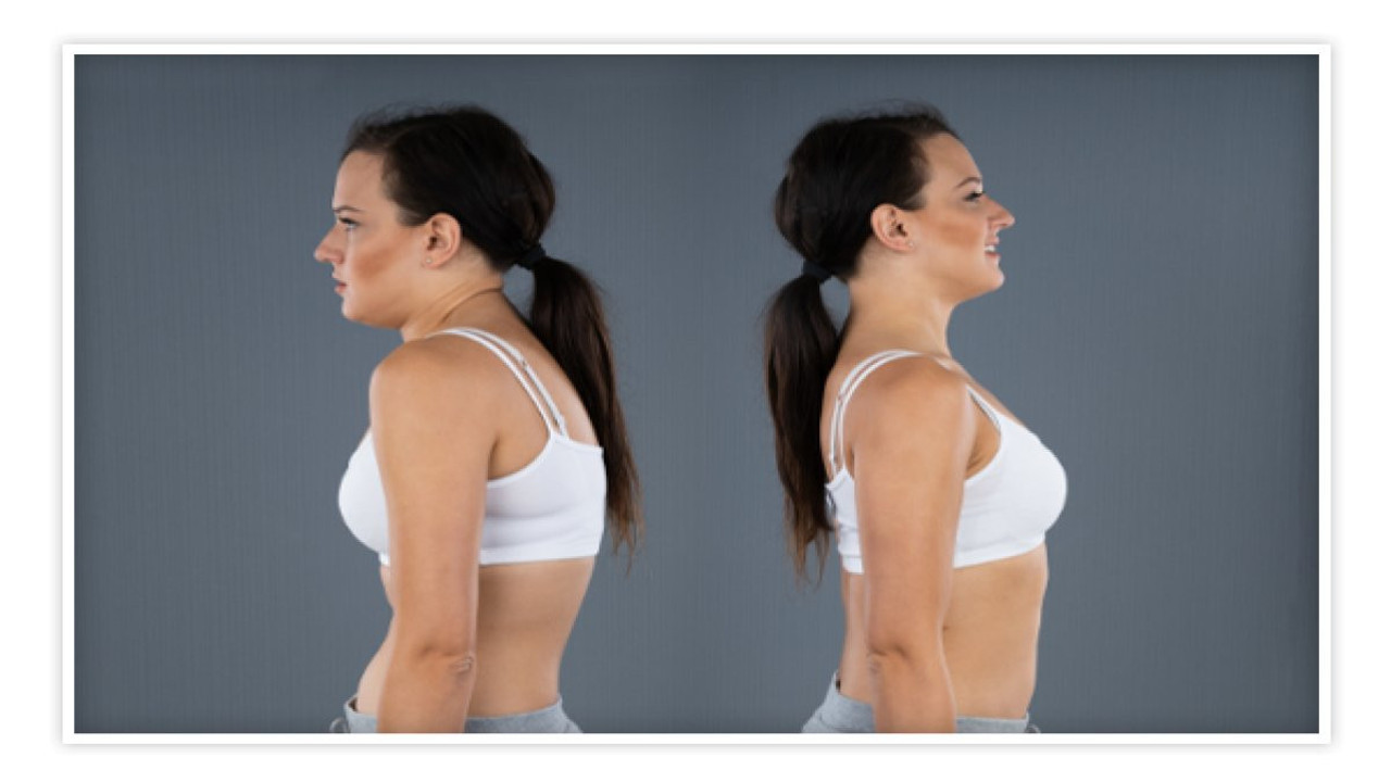 Ofis çalışanları dikkat! Kamburlukla ilgili uzmanlardan kritik uyarılar