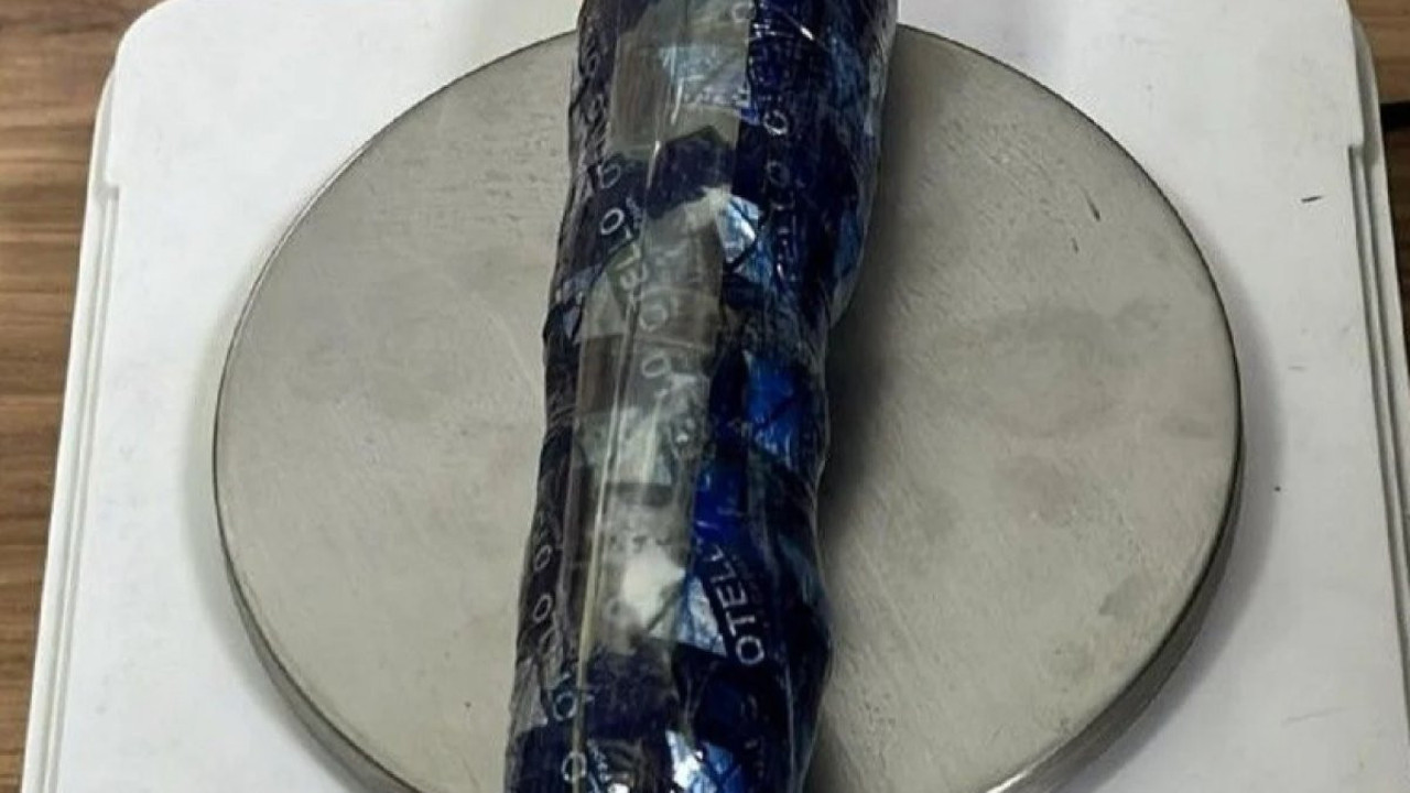 Gümüşhane'de bir garip olay: İki yabancının bağırsağından çıktı