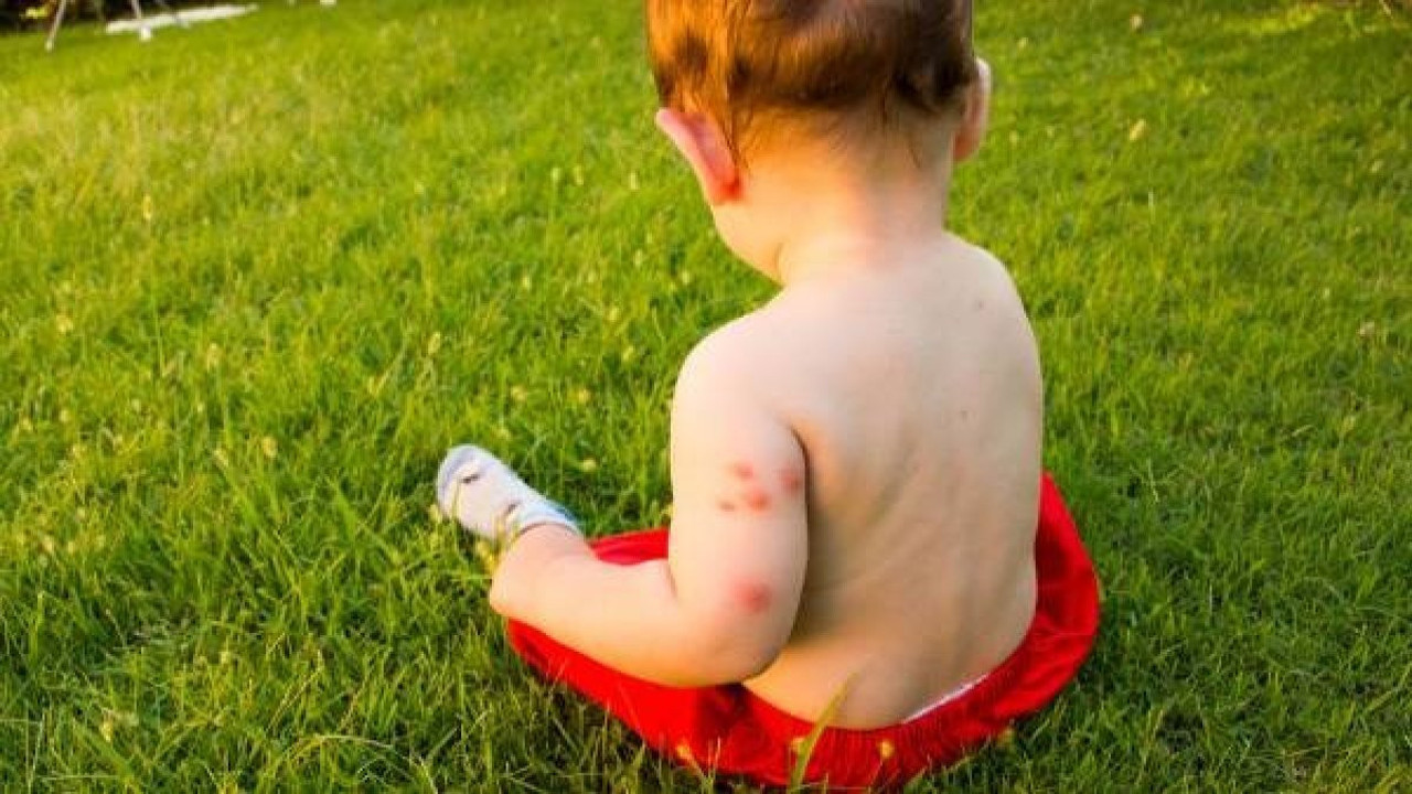 Böcek ısırığında ilk ne yapılmalı? Hayat kurtaran öneriler