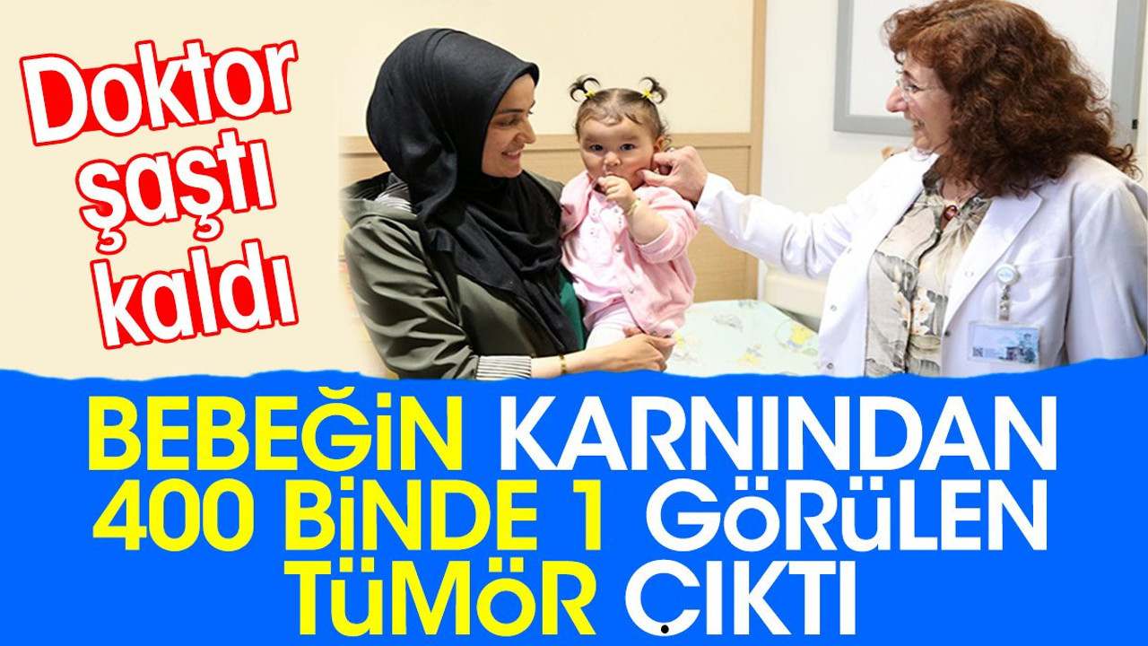 Bebeğin karnından 400 binde 1 görülen tümör çıktı. Doktor şaştı kaldı