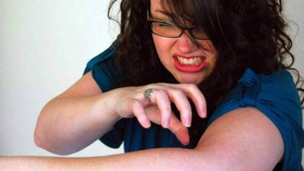 Stresin tetiklediği deri hastalıkları nelerdir? Şifaları nelerdir? İşte uzman görüşleri...