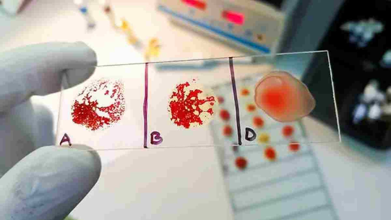 Bu kan grubuna sahip olanlar dikkat! Felç riskini yükseltiyor