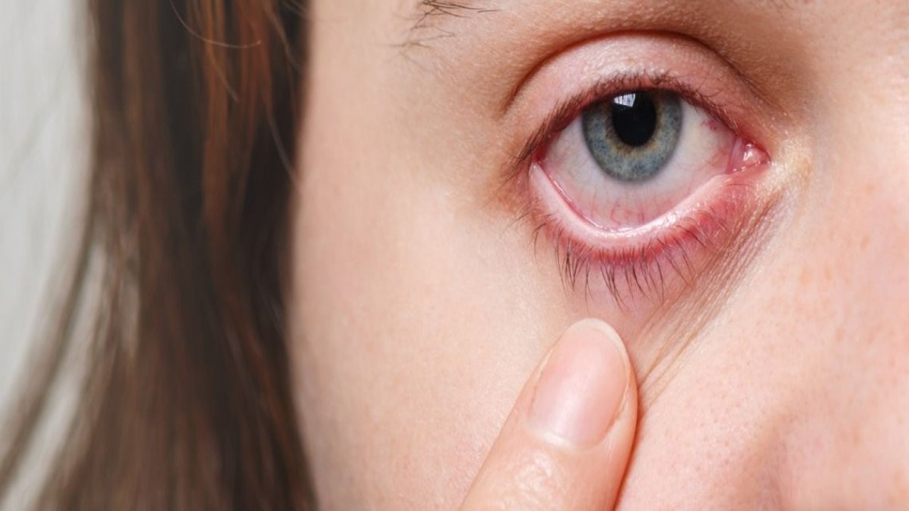 Kışla birlikte gelen göz enfeksiyonlarıyla ilgili uzman uyarıları