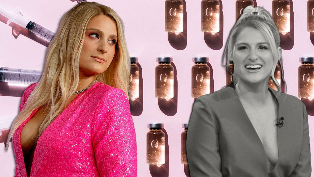 Meghan Trainor gülüşünü botoksa feda etti