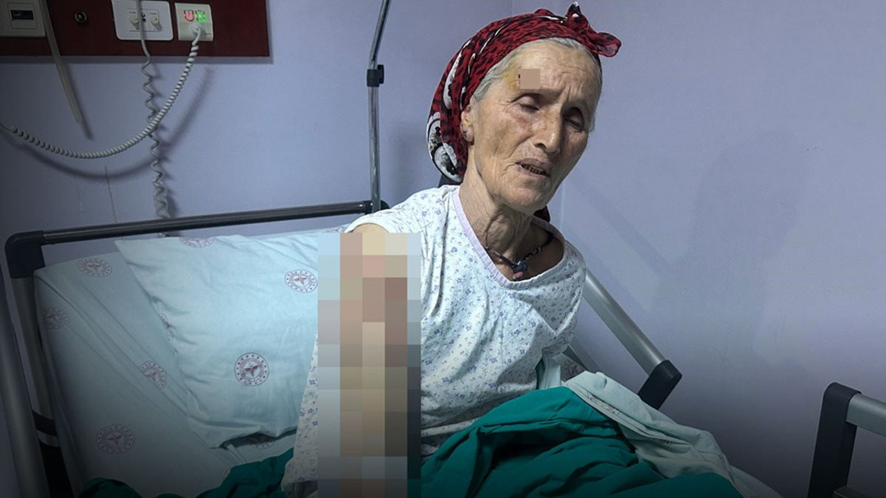 Yaşlı kadına 7 köpek dehşeti yaşattı: Vücuduna tam 50 dikiş atıldı!