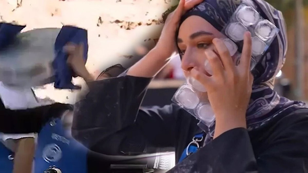 Yüzüne kızgın yağ dökülmüş, kurgu denmişti! MasterChef Beyza yüzünü ilk kez paylaştı