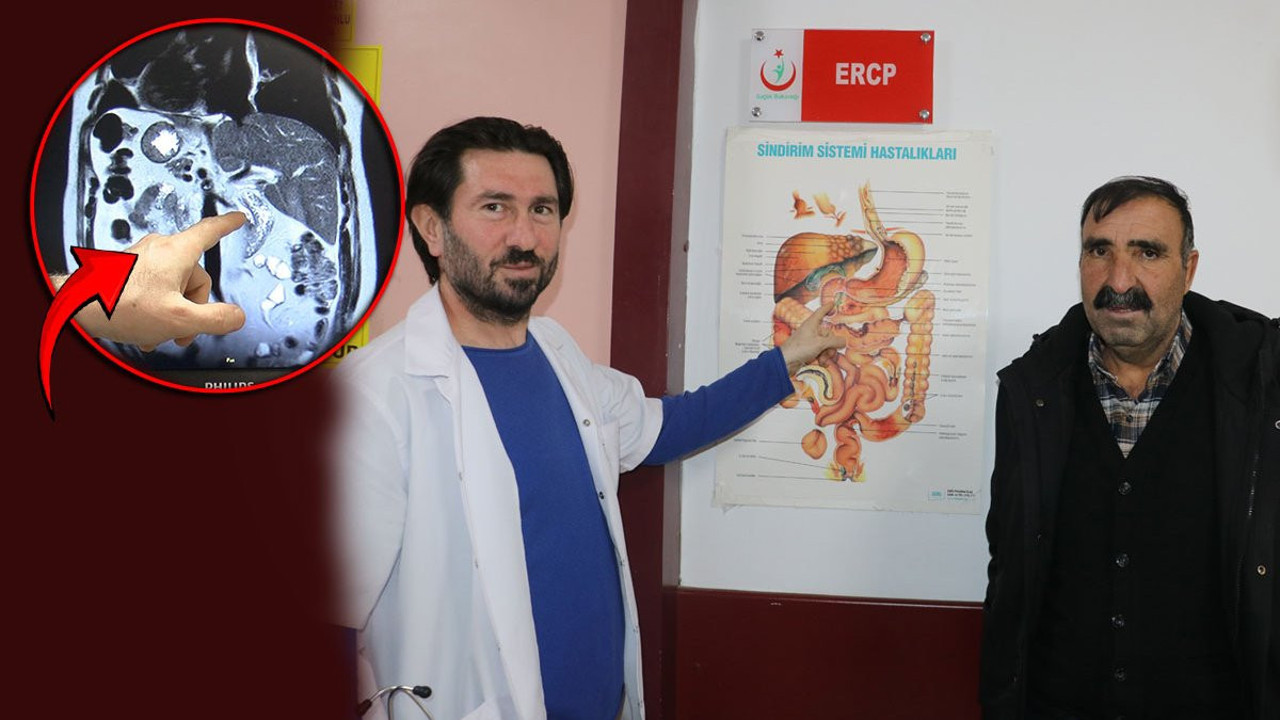 Karın ağrısıyla gitmişti: Dünyada 47, Türkiye'de 2'nci vaka