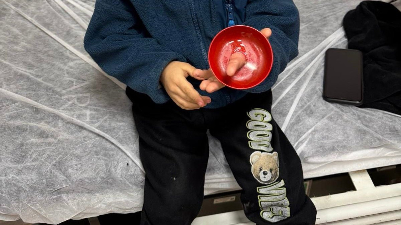 Parmağına zil çanı sıkışan çocuk için seferber oldular