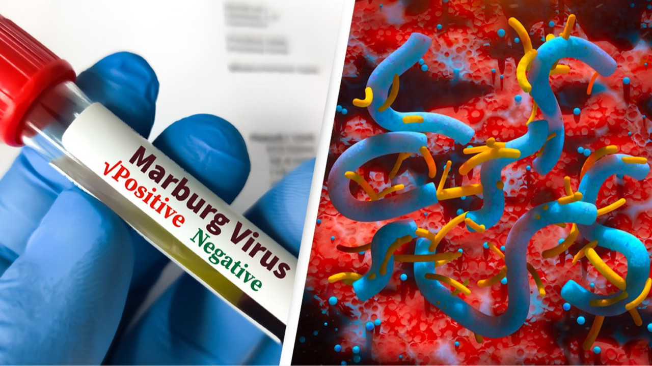Tanzanya hükümetinden Marburg virüsü hakkında açıklama geldi