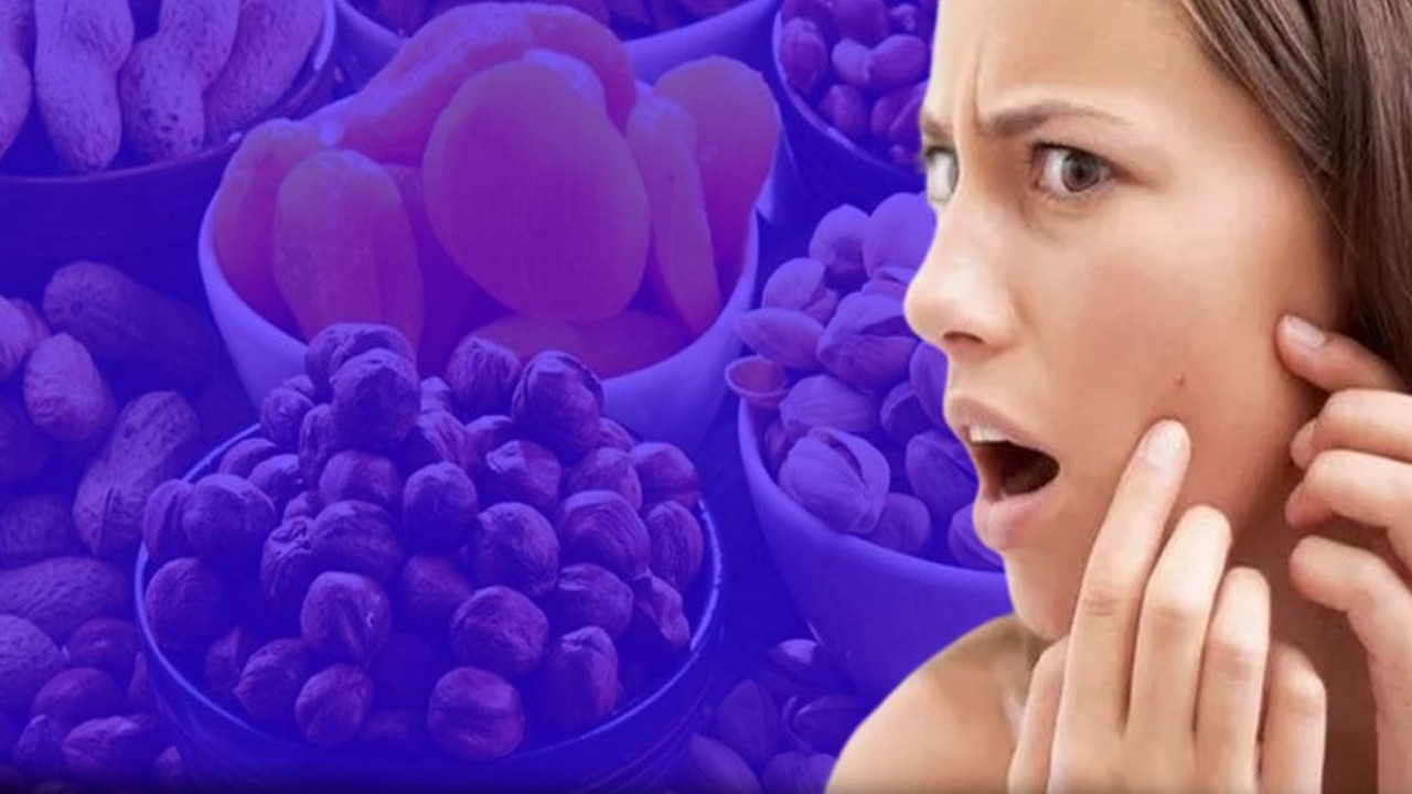 Sivilceyi tetikleyen 10 besin! Uzmanlar uyarılarını sıraladı