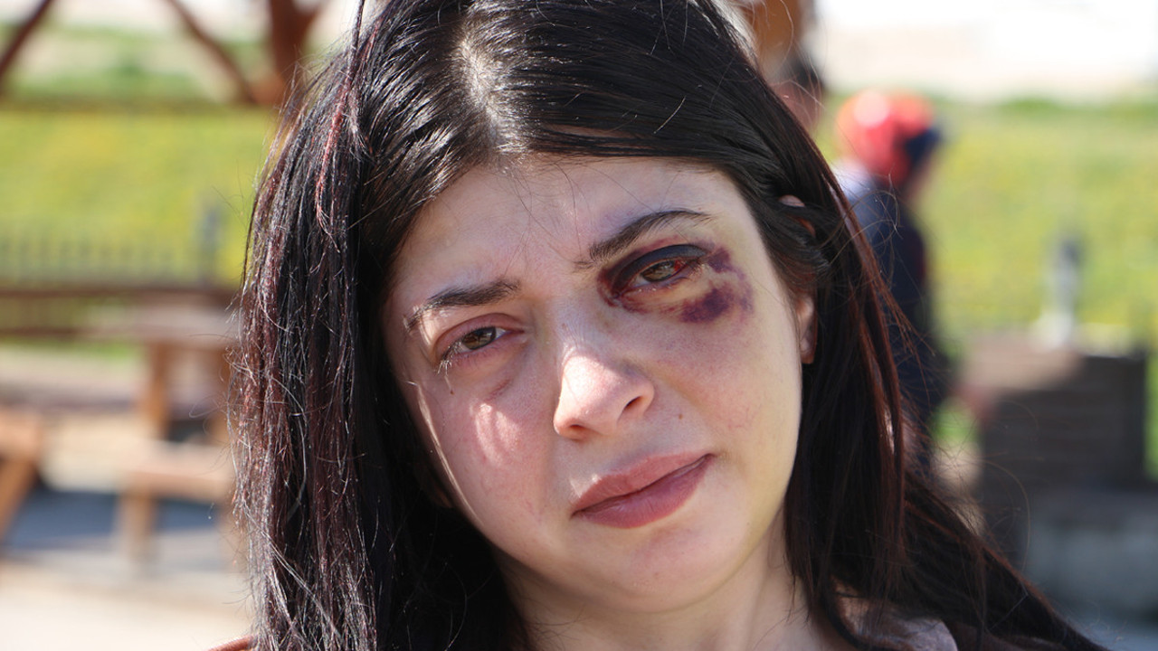 Alışverişe diye çıktı tacize uğradı! Aldığı darbeler nedeniyle 3 ay sıvı beslenecek