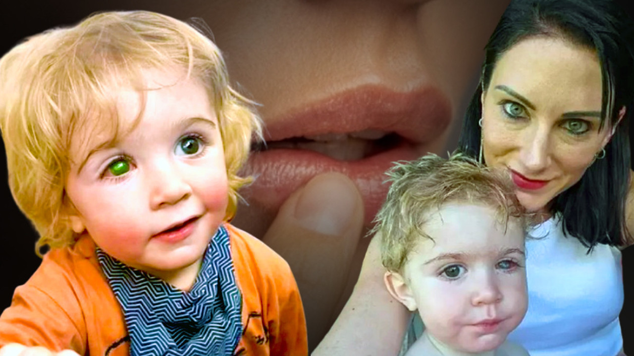 Anne babalar dikkat! 2 yaşındaki çocuk öpüldüğü için kör oldu