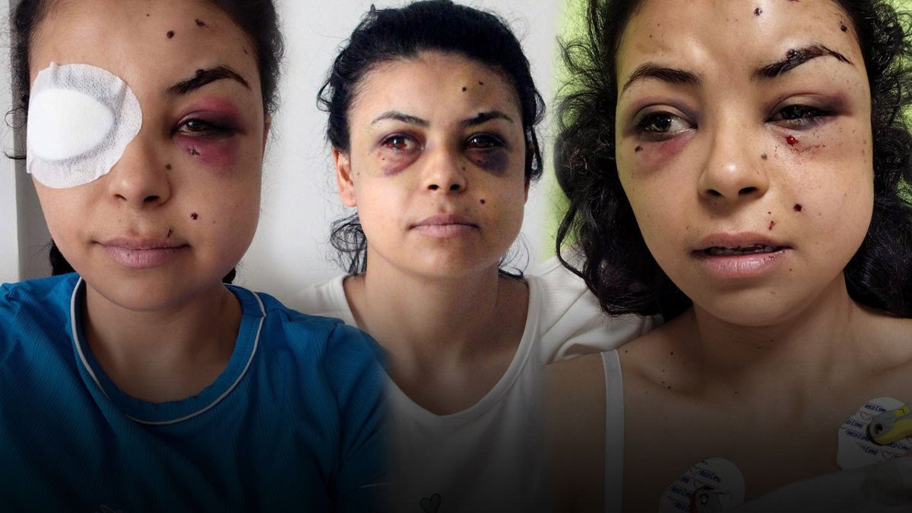 Düğün eğlencesi kabusla bitti! Genç kızın hayatını kararttı...