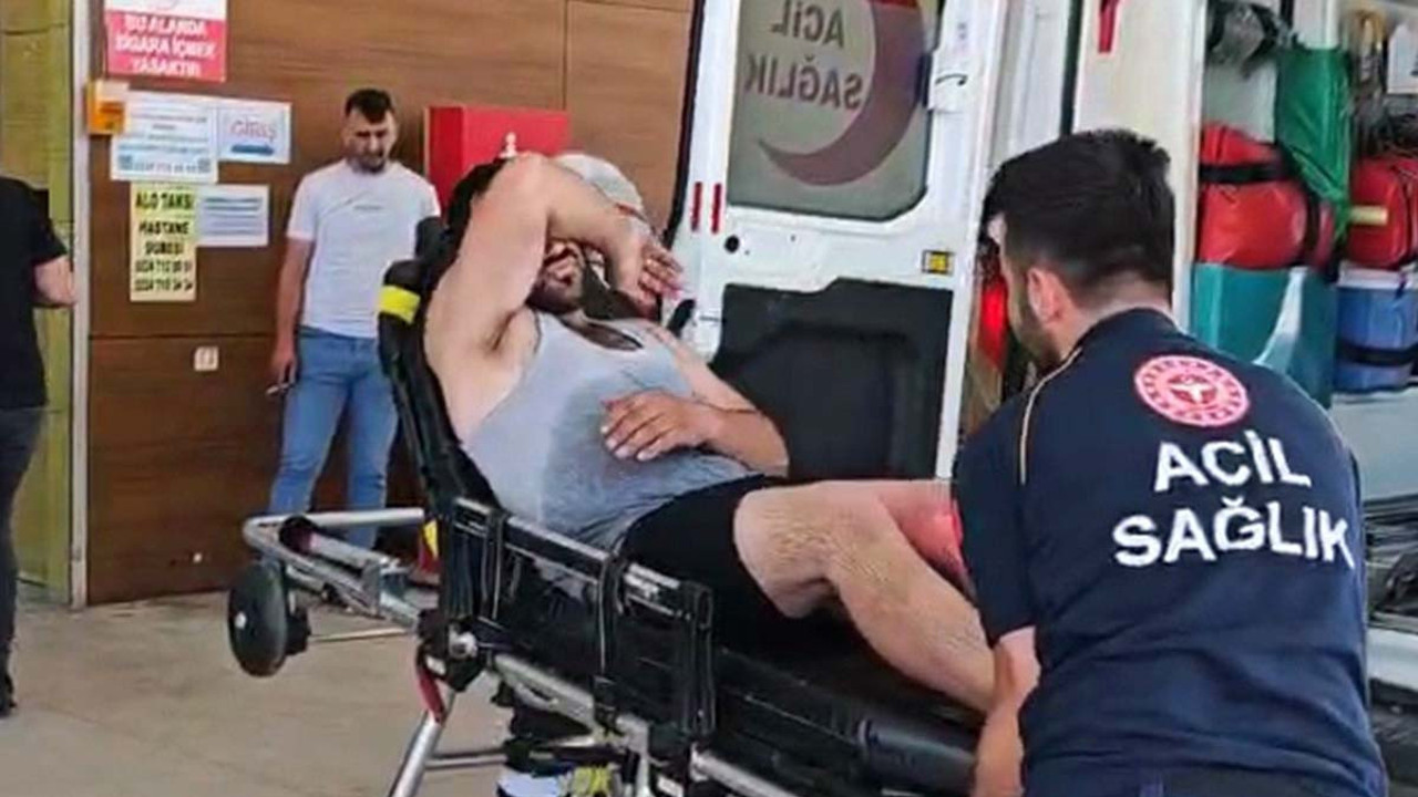 Oto tamircisinde korku dolu anları! Kaynar su felaketini yaşadı