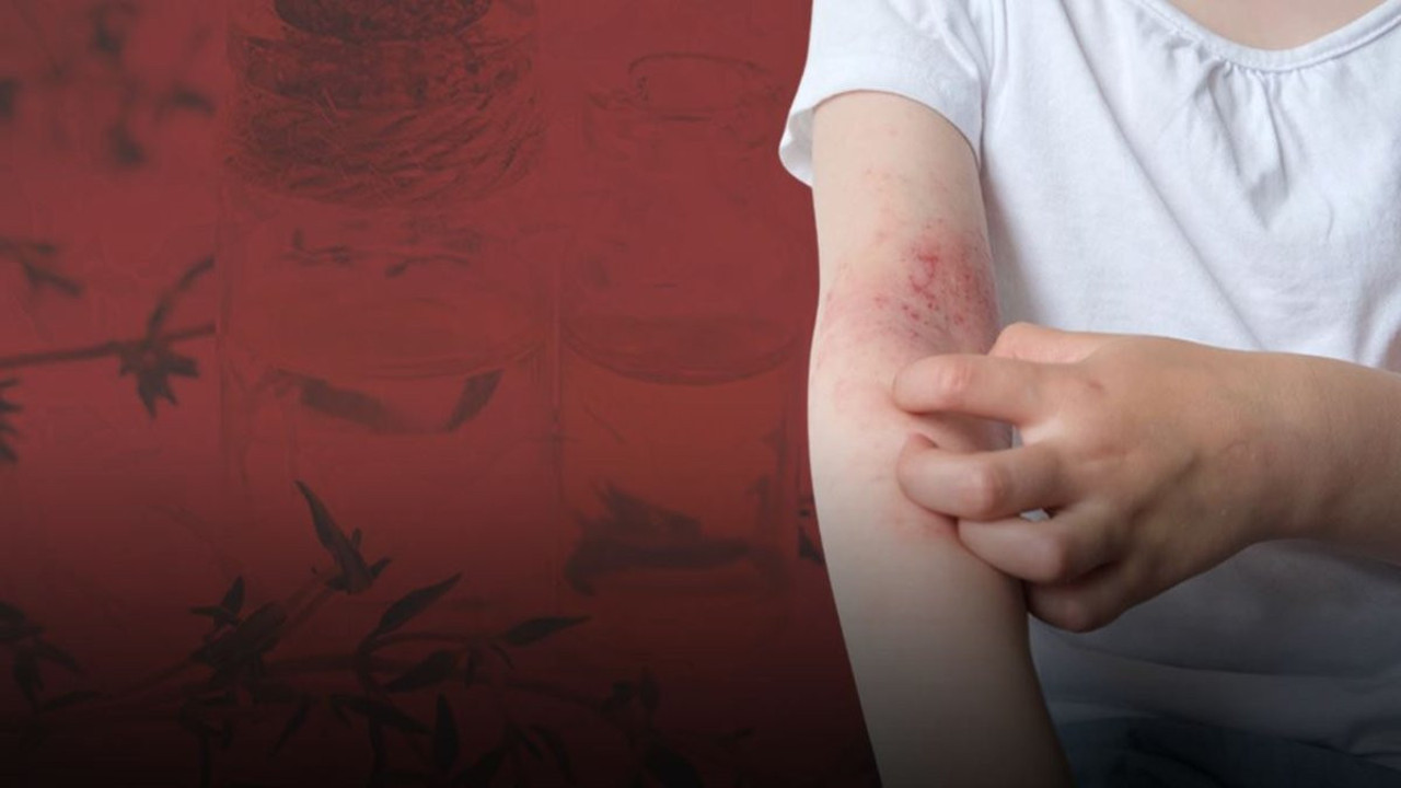 Asırlık reçete Güneydoğu’dan çıktı! Mantar ve egzamaya doğal darbe