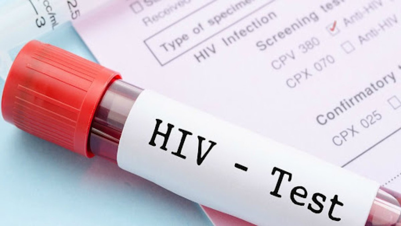 AIDS'te tedaviye giden yolda dev adım! HIV bitecek mi?