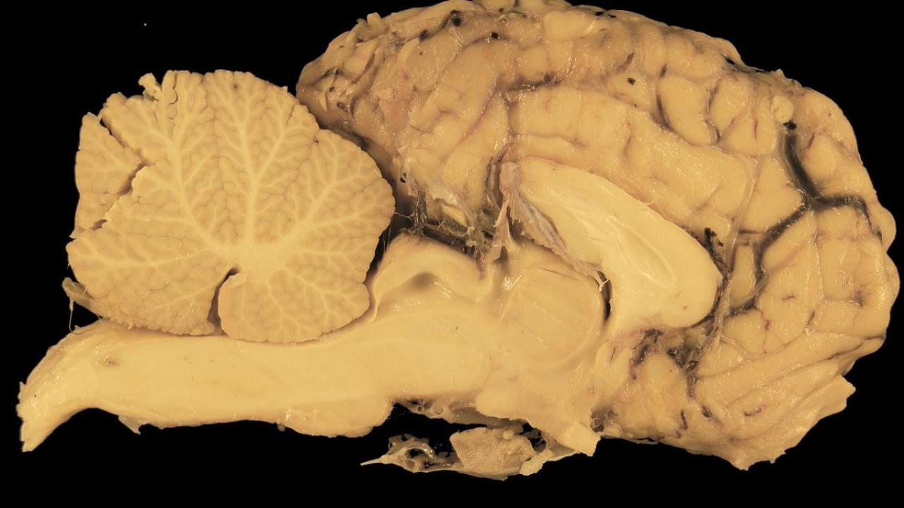 Beyne iyi gelen besin! Günde 5 tane yemek yeterliymiş