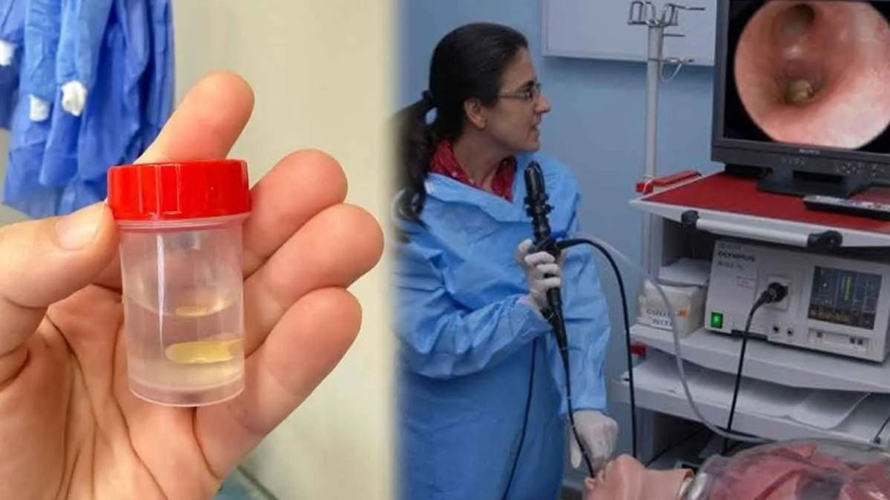 Denizli’de inanılmaz olay! Akciğer enfeksiyonu sandılar: Gerçek 5 ay sonra ortaya çıktı