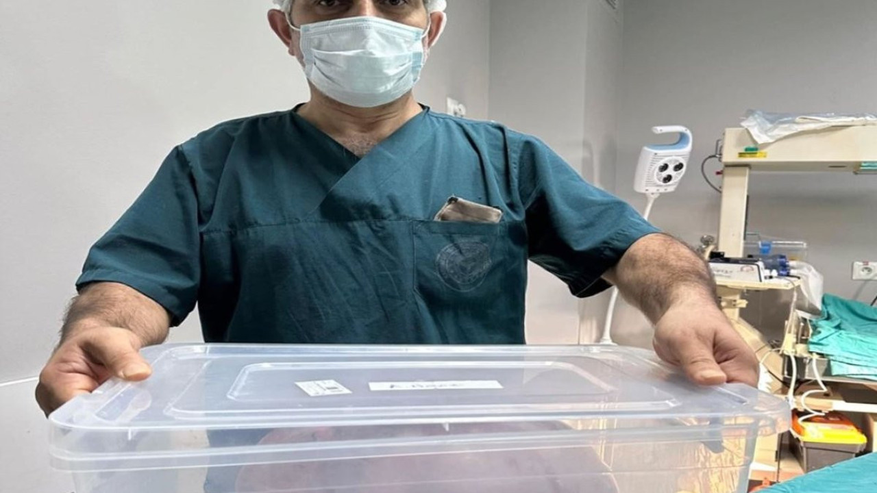 Yumurtalıktan çıkan dev kitle şoke etti! Doktorlar bile hayrete düşürdü