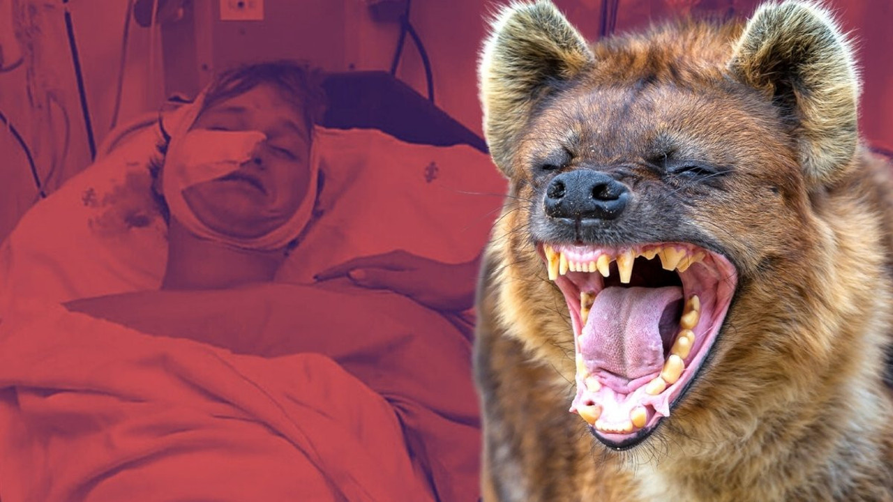 Kamp tatili kabusa döndü: Sırtlan saldırısından 30 dikişle kurtuldu