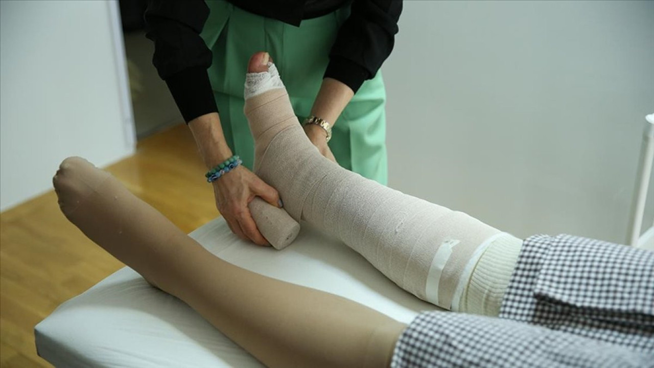 Yanlış sülük tedavisinin hayati tehlikeleri! Uzmanlardan kritik öneriler