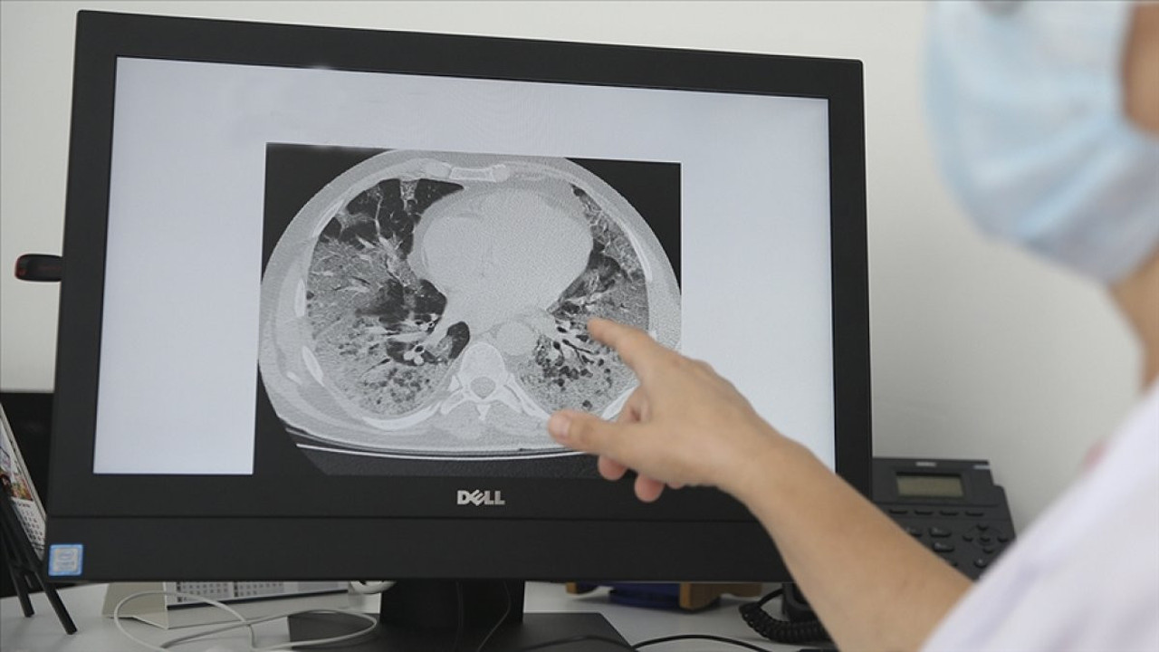 Sessiz katil mi? Yüksek ölüm oranı uzmanları endişelendiriyor! Uzmanlar anlattı