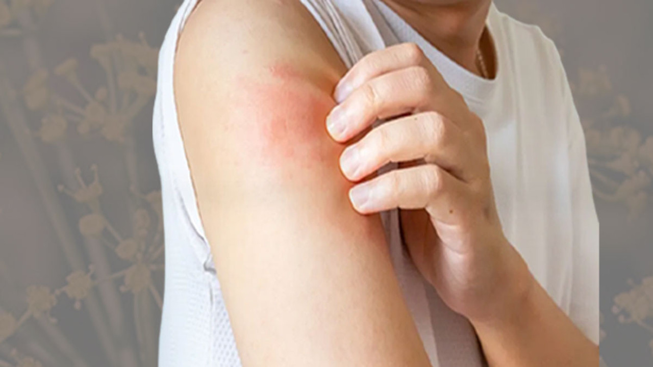 Bin yıllık şifalı ot mucize saçıyor! Anadolu'nun bereketli topraklarından fışkırıyor! İştah açıcı bitki egzamayı iyileştiriyor