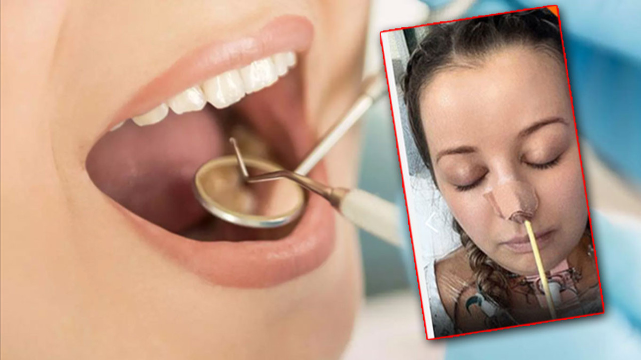 Hayatının şokunu yaşayan kadının dilinin yarısını aldılar! Doktora gitti gerçek bambaşka çıktı