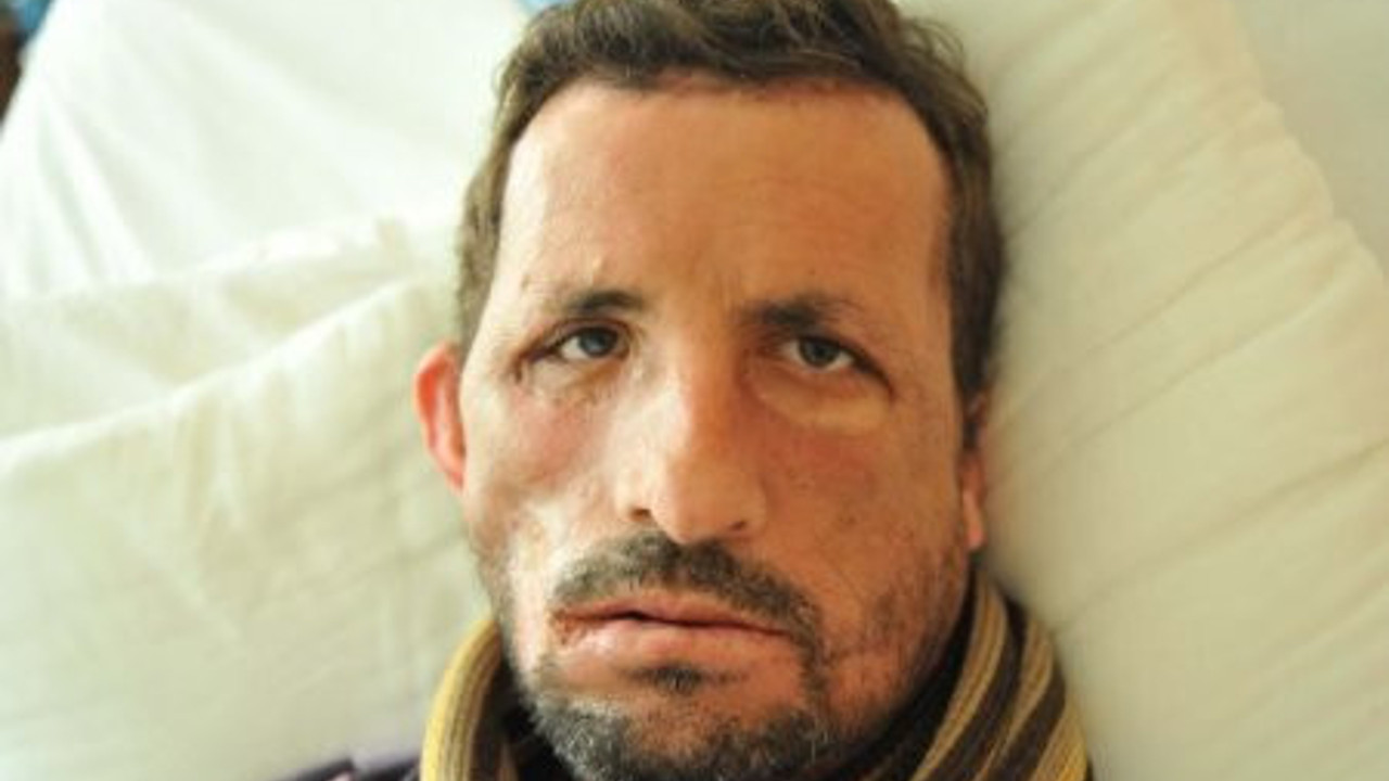 İlk yüz nakline 'cinayet' davası