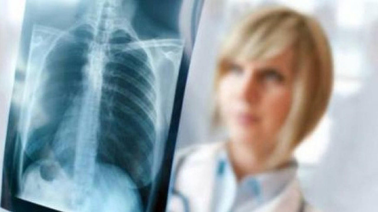 Öksürük ve balgam KOAH belirtisi