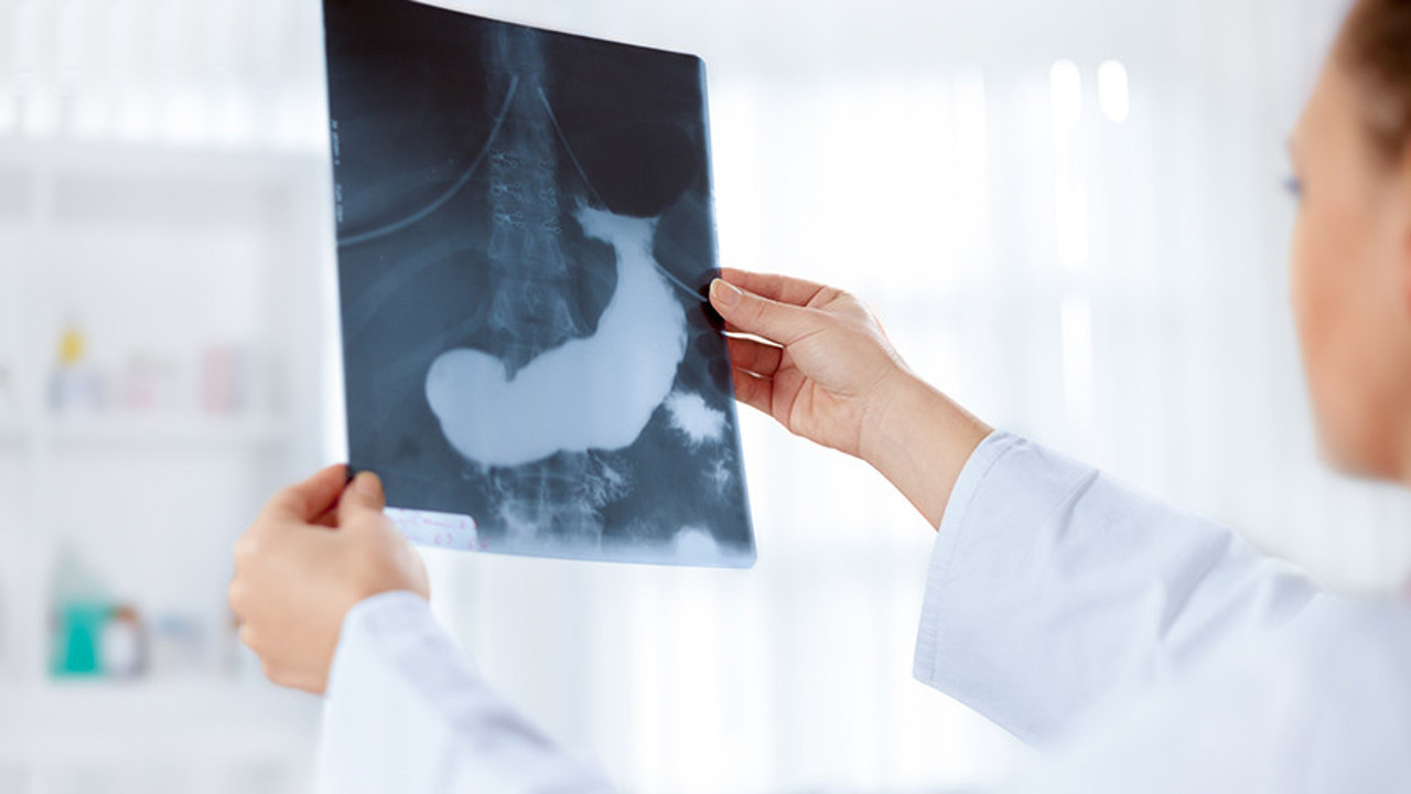 Erken tanısı en zor olan kanser