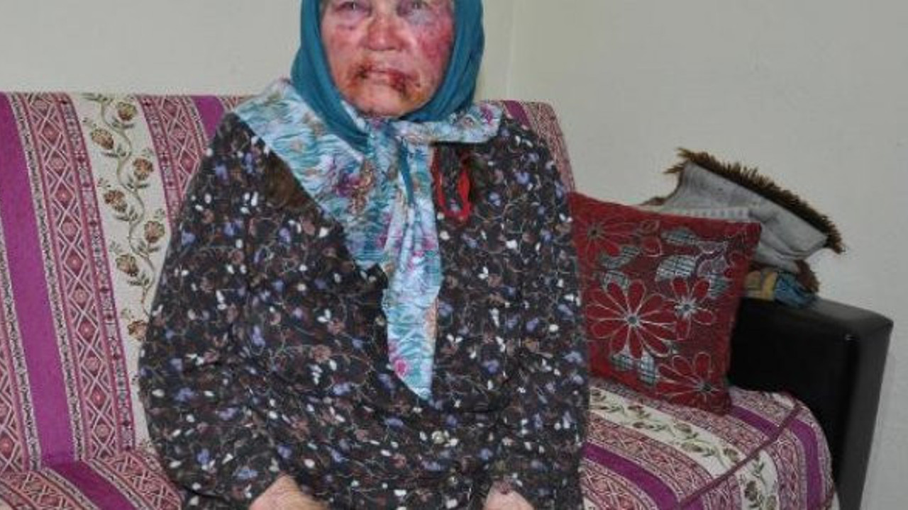 75 yaşındaki kadına öldüresiye dayak