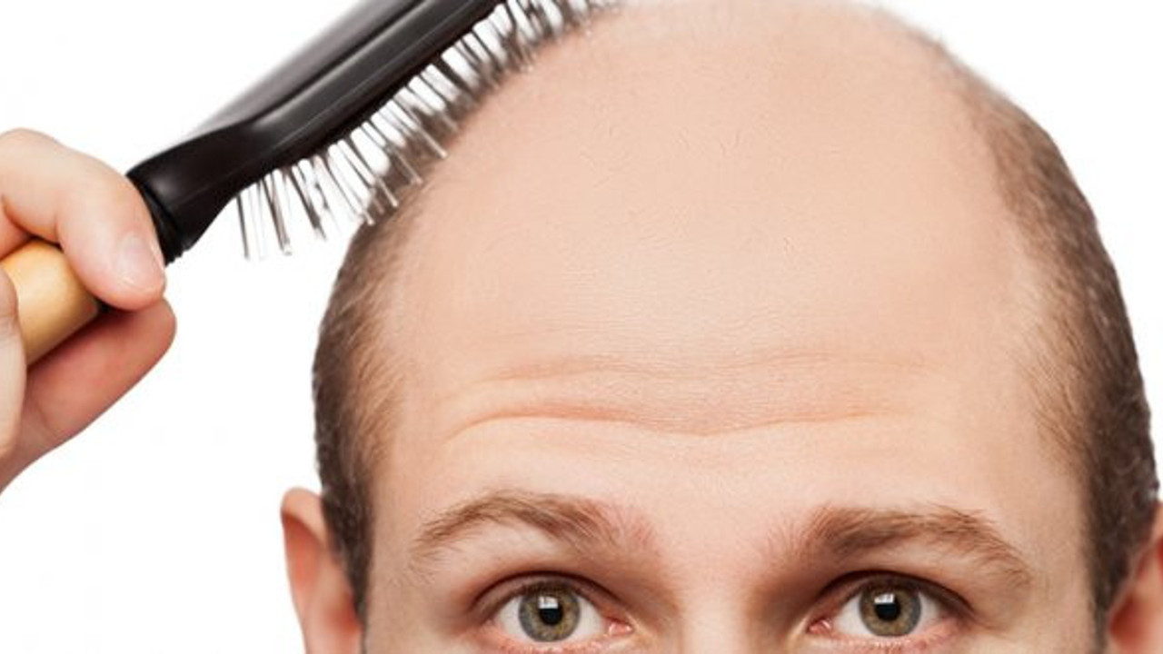 Saç dökülmesine ne sebep olur, nasıl önlenir?